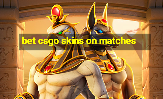 bet csgo skins on matches