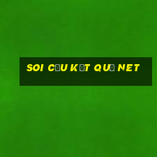 soi cầu kết quả net