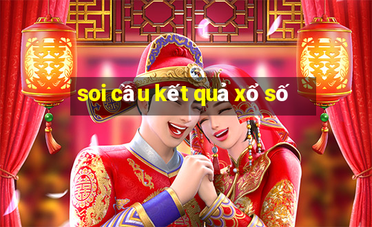 soi cầu kết quả xổ số