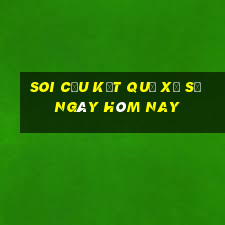 soi cầu kết quả xổ số ngày hôm nay