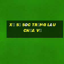 xổ số sóc trăng lâu chưa về